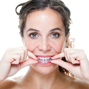 woman with Invisalign Clear Aligner